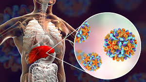 Pencegahan Hepatitis: Langkah-Langkah Perlindungan Terhadap Hati